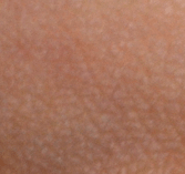 Aufbau der Epidermis