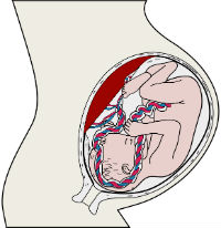 Ftus im Bauch der Mutter